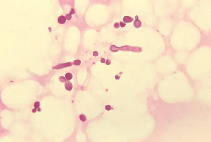 Malassezia slooffiae (Malassezia slooffiae) — photo mycologique