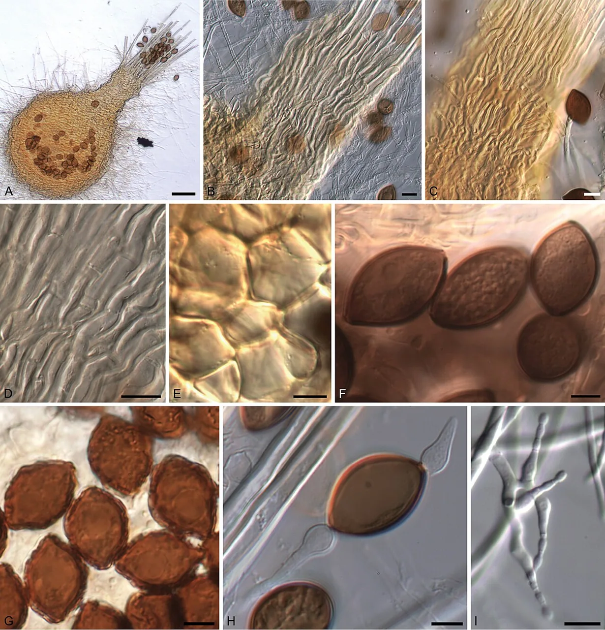 Melanospora arenaria (Melanospora arenaria) — photo mycologique