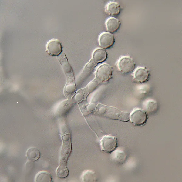 Microascus murinus (Microascus murinus) — photo mycologique
