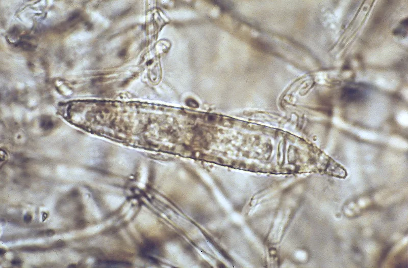 Microsporum audouinii (Microsporum audouinii) — photo mycologique