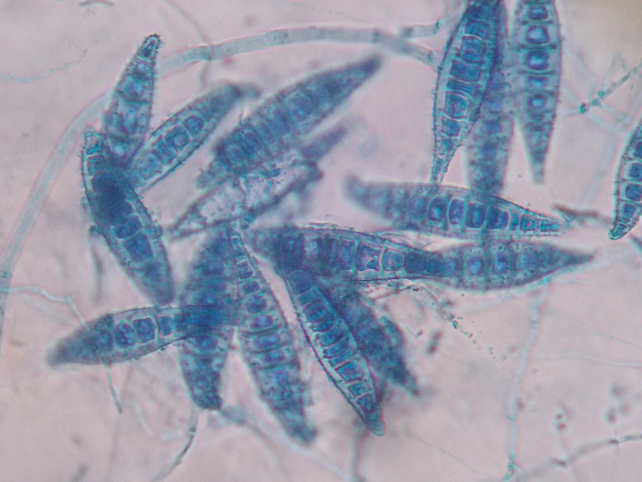 Microsporum ferrugineum (Microsporum ferrugineum) — photo mycologique