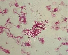 Morganella samoensis (Morganella samoensis) — photo mycologique