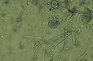 Mucor circinelloides (Mucor circinelloides) — photo mycologique