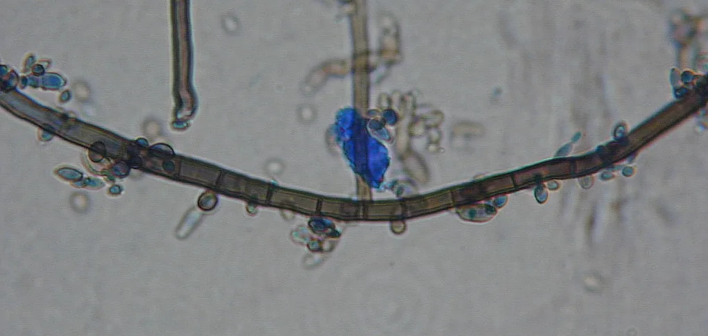 Neodothiora populina (Neodothiora populina) — photo mycologique