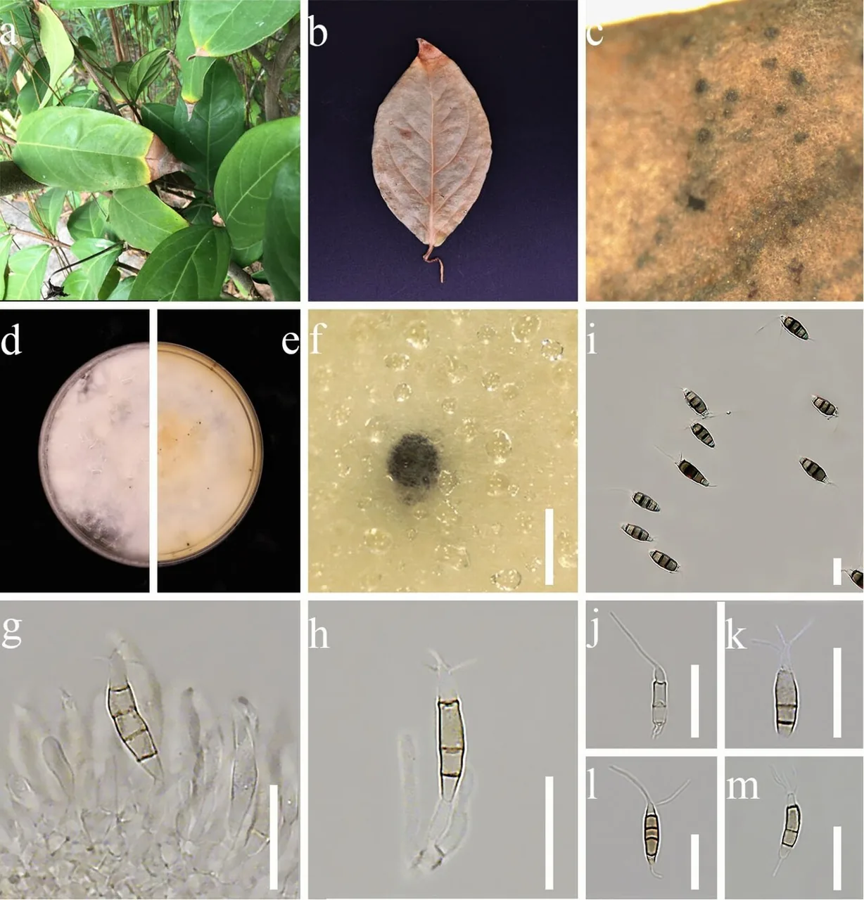 Neopestalotiopsis longiappendiculata (Neopestalotiopsis longiappendiculata) — photo mycologique