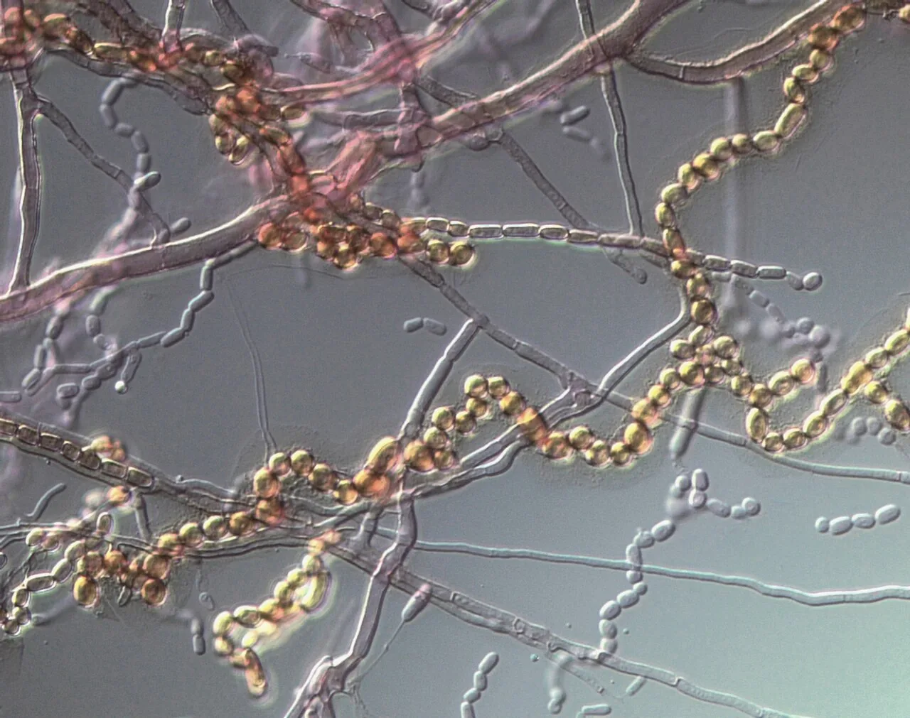 Neoscytalidium dimidiatum (Neoscytalidium dimidiatum) — photo mycologique