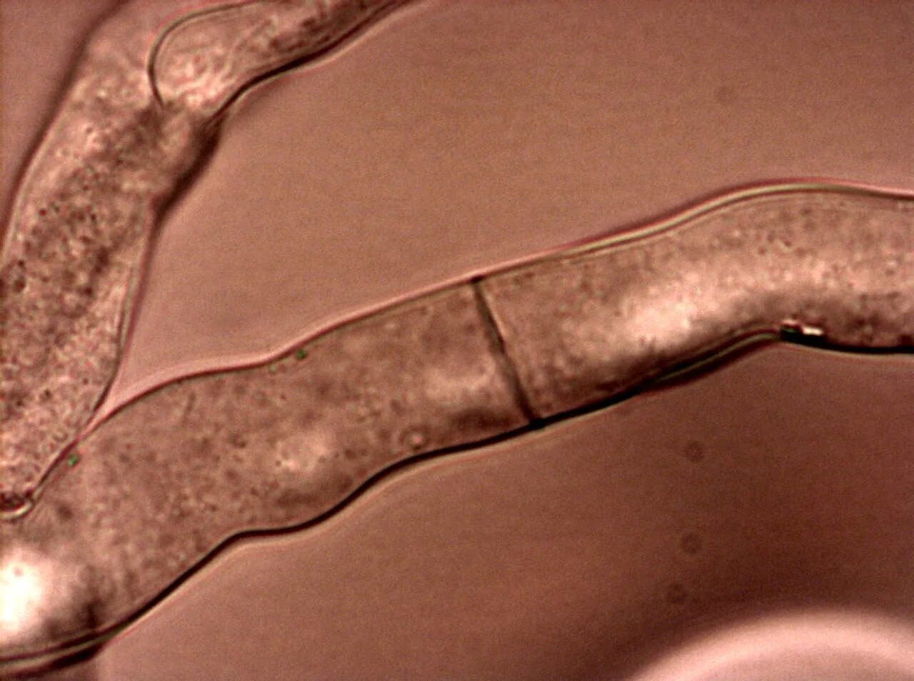 Neurospora crassa (Neurospora crassa) — photo mycologique