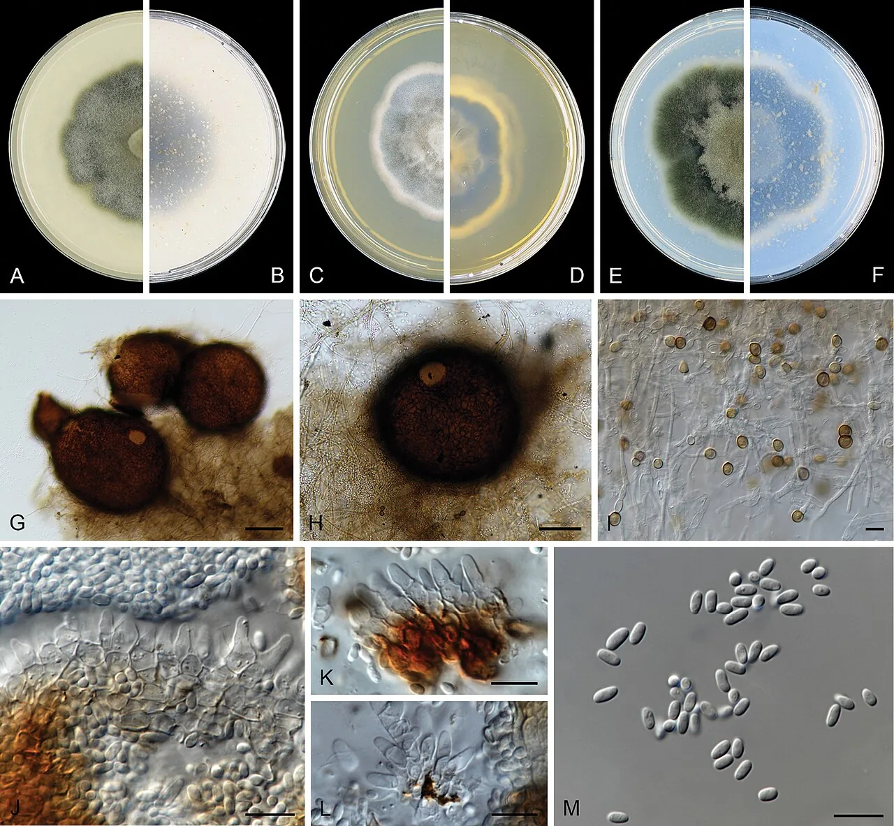 Nothophoma taboriae (Nothophoma taboriae) — photo mycologique