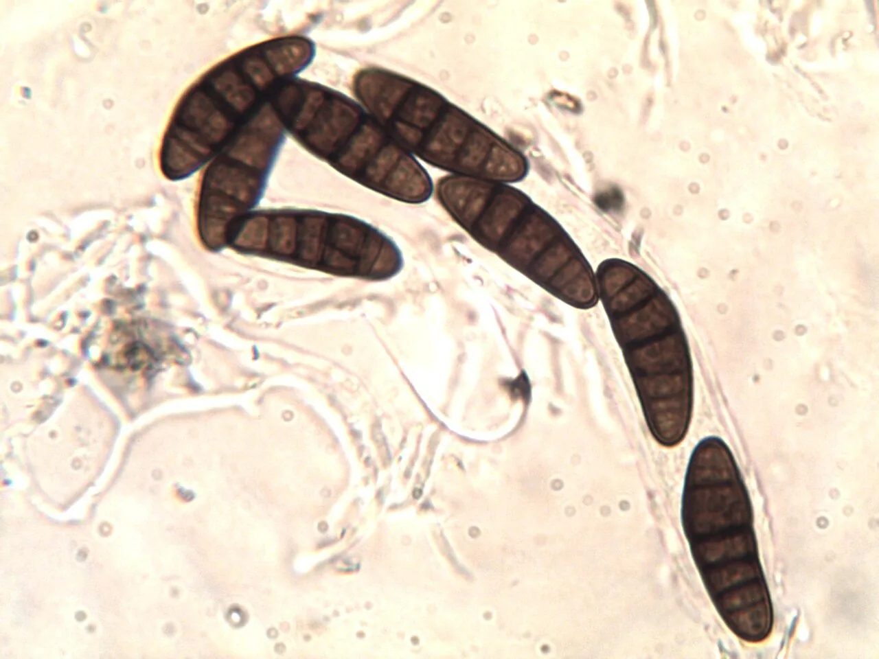 Oedohysterium sinense (Oedohysterium sinense) — photo mycologique