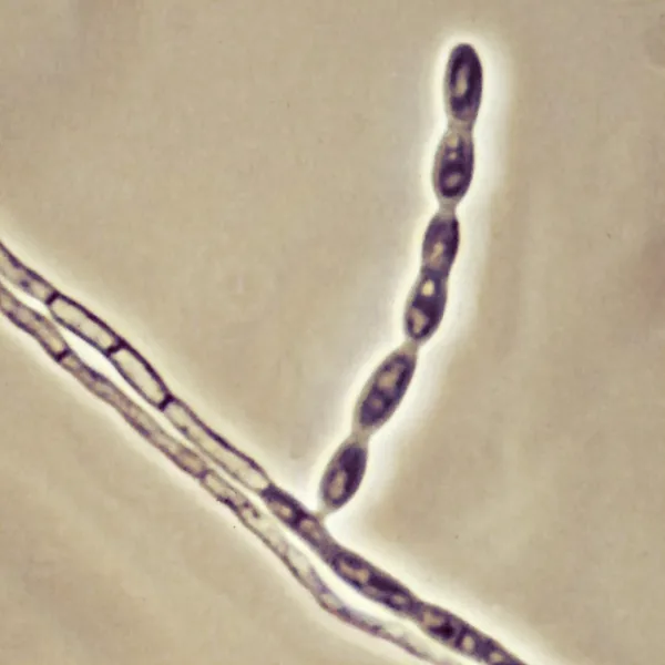 Onychocola glareosa (Onychocola glareosa) — photo mycologique