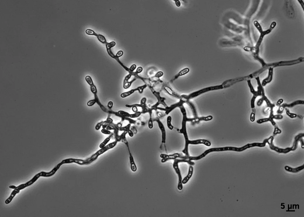 Ophidiomyces ophidiicola (Ophidiomyces ophidiicola) — photo mycologique