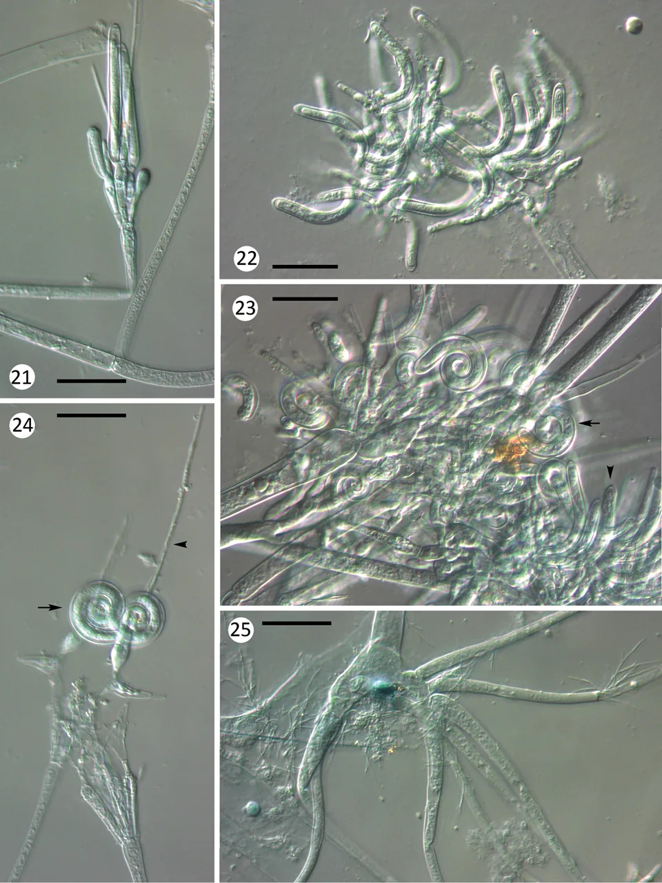 Orphella coronata (Orphella coronata) — photo mycologique