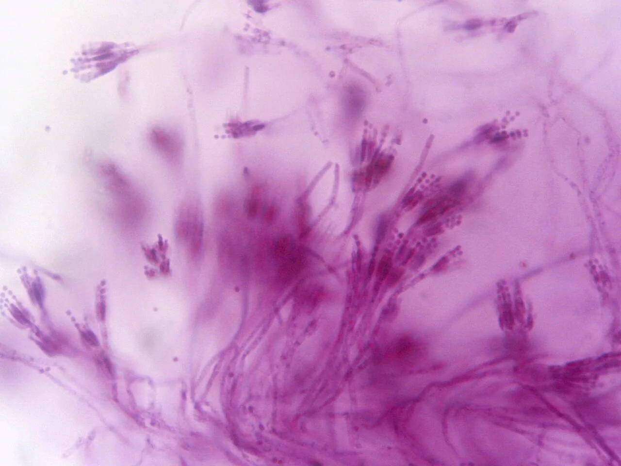 Penicillium archerae (Penicillium archerae) — photo mycologique