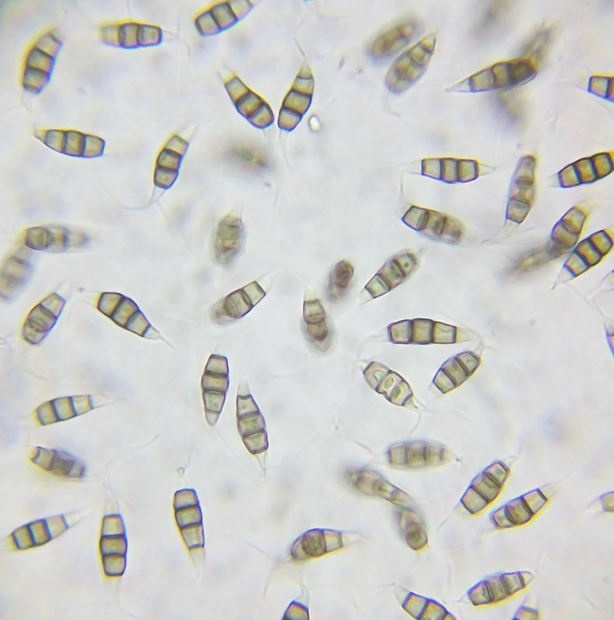 Pestalotiopsis australis (Pestalotiopsis australis) — photo mycologique