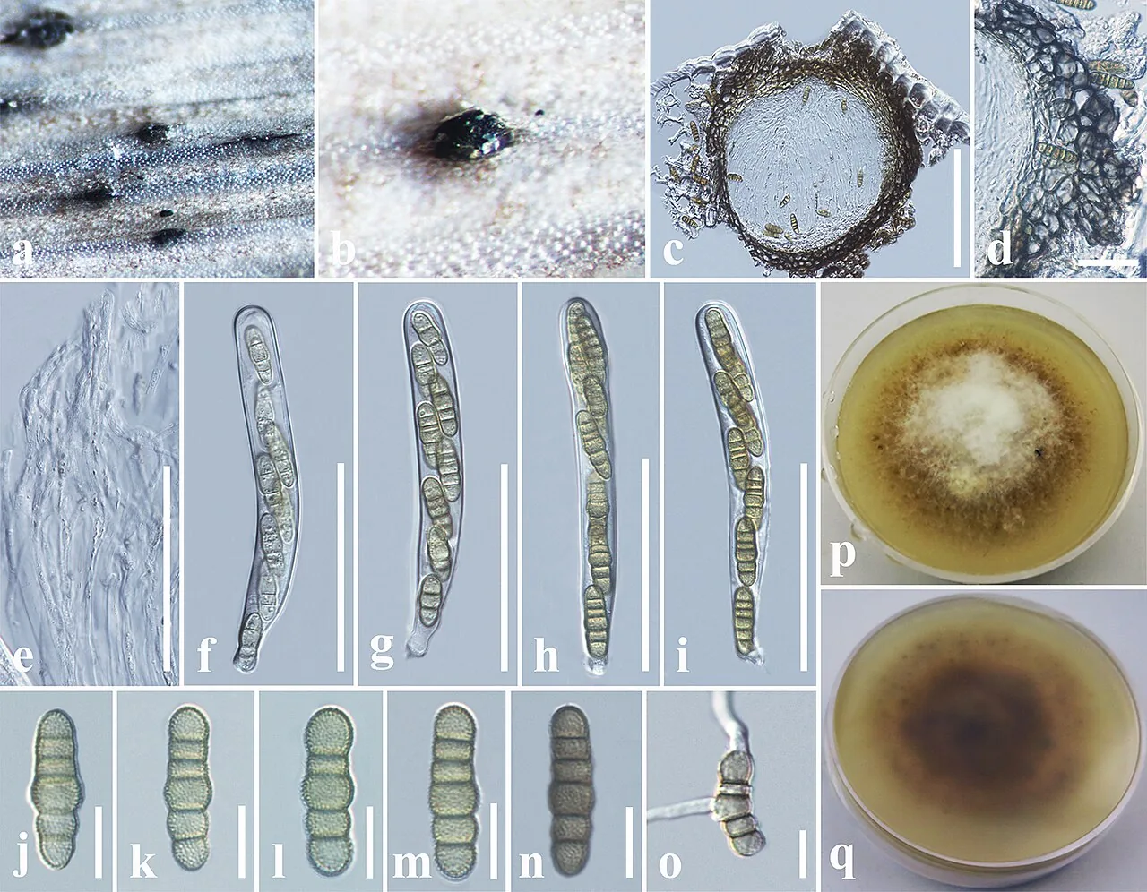 Phaeosphaeriopsis agavensis (Phaeosphaeriopsis agavensis) — photo mycologique