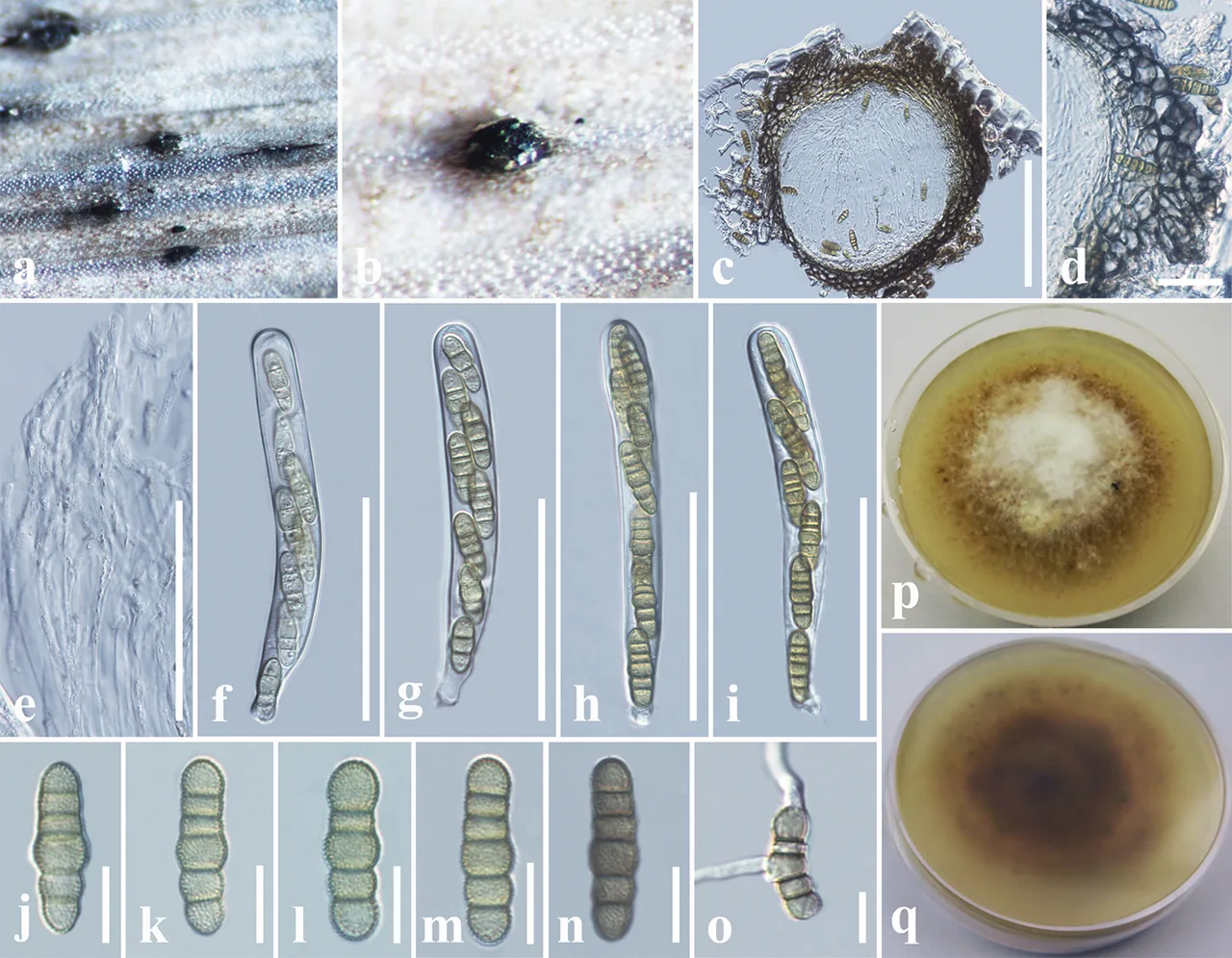 Phaeosphaeriopsis aloes (Phaeosphaeriopsis aloes) — photo mycologique