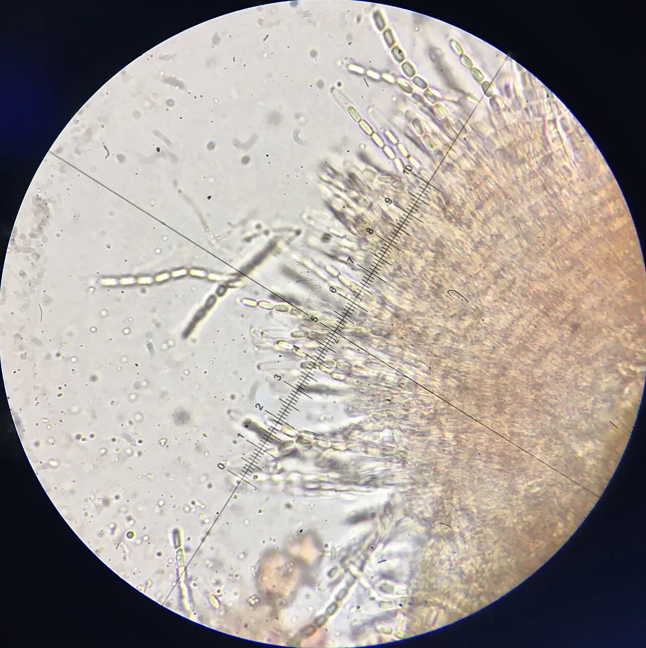 Phomatospora endopteris (Phomatospora endopteris) — photo mycologique