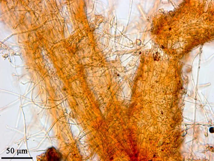 Phymatotrichopsis omnivora (Phymatotrichopsis omnivora) — photo mycologique