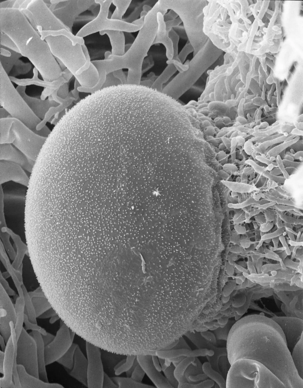 Pilaira anomala (Pilaira anomala) — photo mycologique