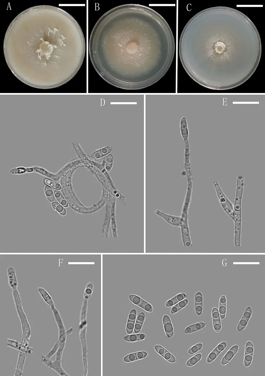 Plectosphaerella niemeijerarum (Plectosphaerella niemeijerarum) — photo mycologique