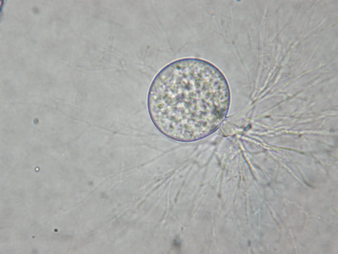 Podochytrium clavatum (Podochytrium clavatum) — photo mycologique
