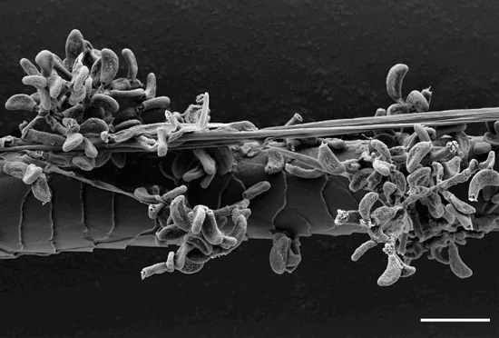 Pseudogymnoascus shaanxiensis (Pseudogymnoascus shaanxiensis) — photo mycologique