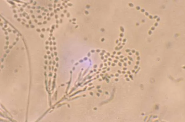 Purpureocillium lavendulum (Purpureocillium lavendulum) — photo mycologique