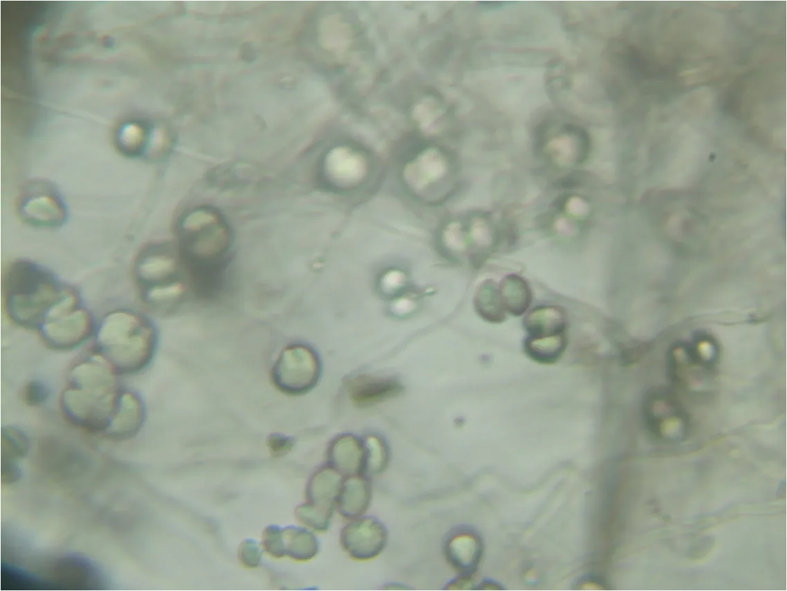 Pyrenophora seminiperda (Pyrenophora seminiperda) — photo mycologique