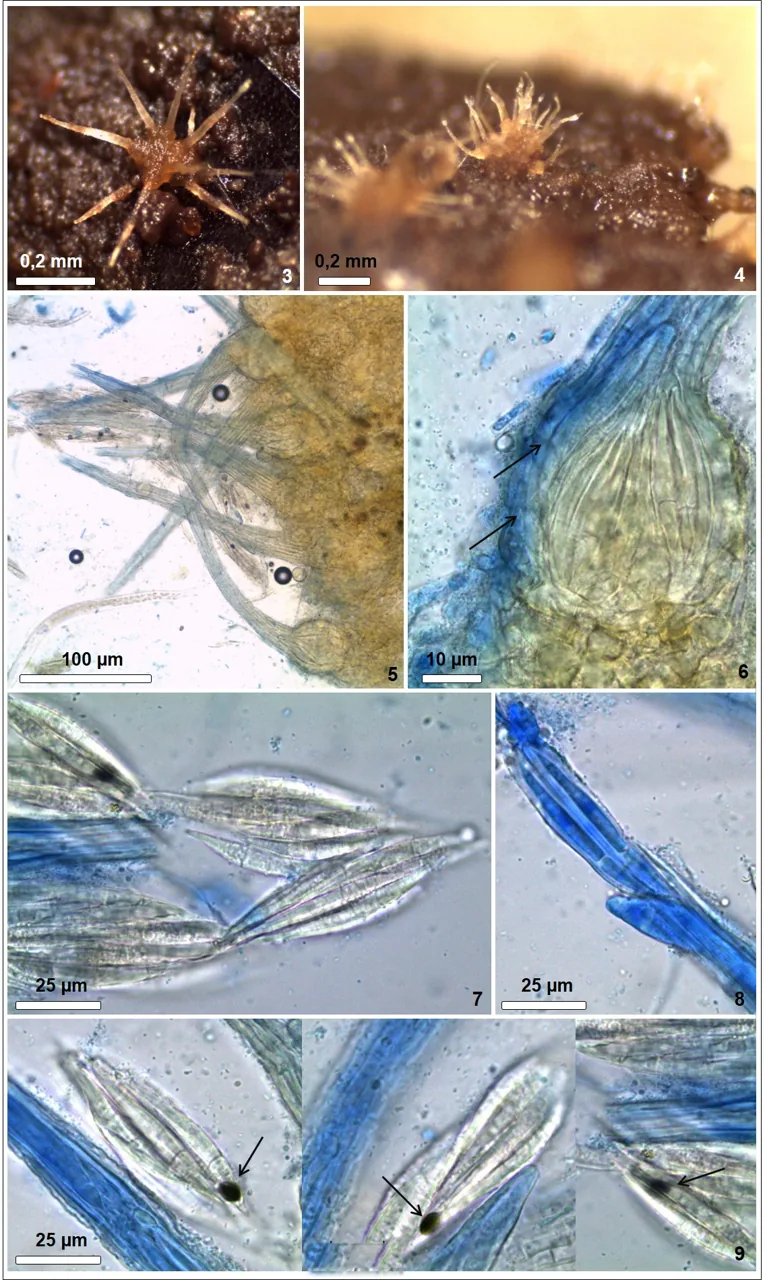 Pyxidiophora spinuliformis (Pyxidiophora spinuliformis) — photo mycologique