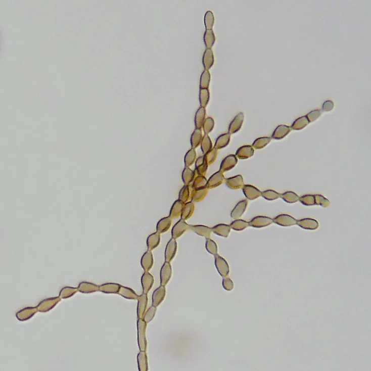Rachicladosporium pini (Rachicladosporium pini) — photo mycologique