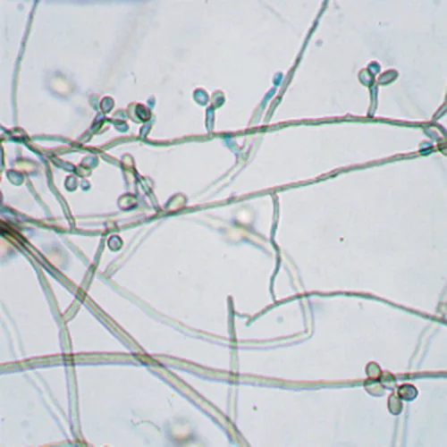 Rhinocladiella fasciculata (Rhinocladiella fasciculata) — photo mycologique