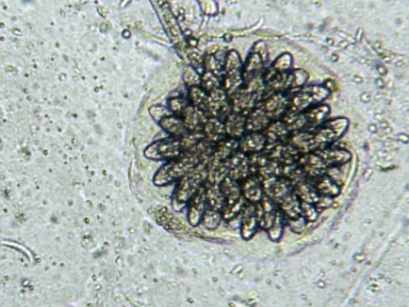 Rhopalomyces cervinus (Rhopalomyces cervinus) — photo mycologique