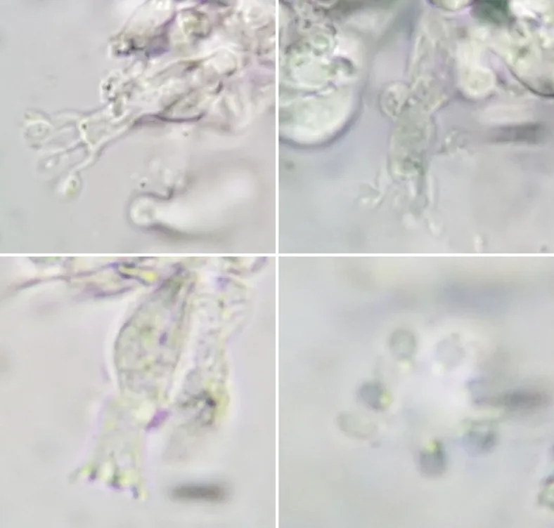 Sistotrema schultheisii (Sistotrema schultheisii) — photo mycologique