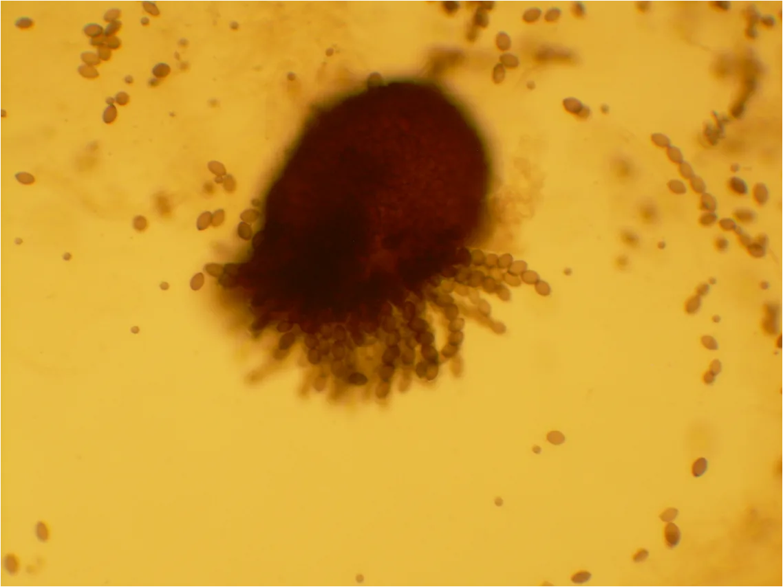 Sordaria arctica (Sordaria arctica) — photo mycologique