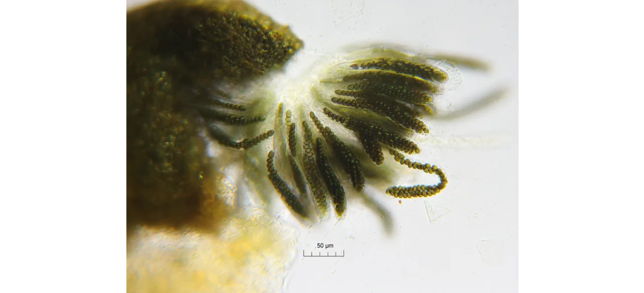 Sporormiella tomilinii (Sporormiella tomilinii) — photo mycologique