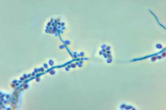 Sporothrix epigloea (Sporothrix epigloea) — photo mycologique