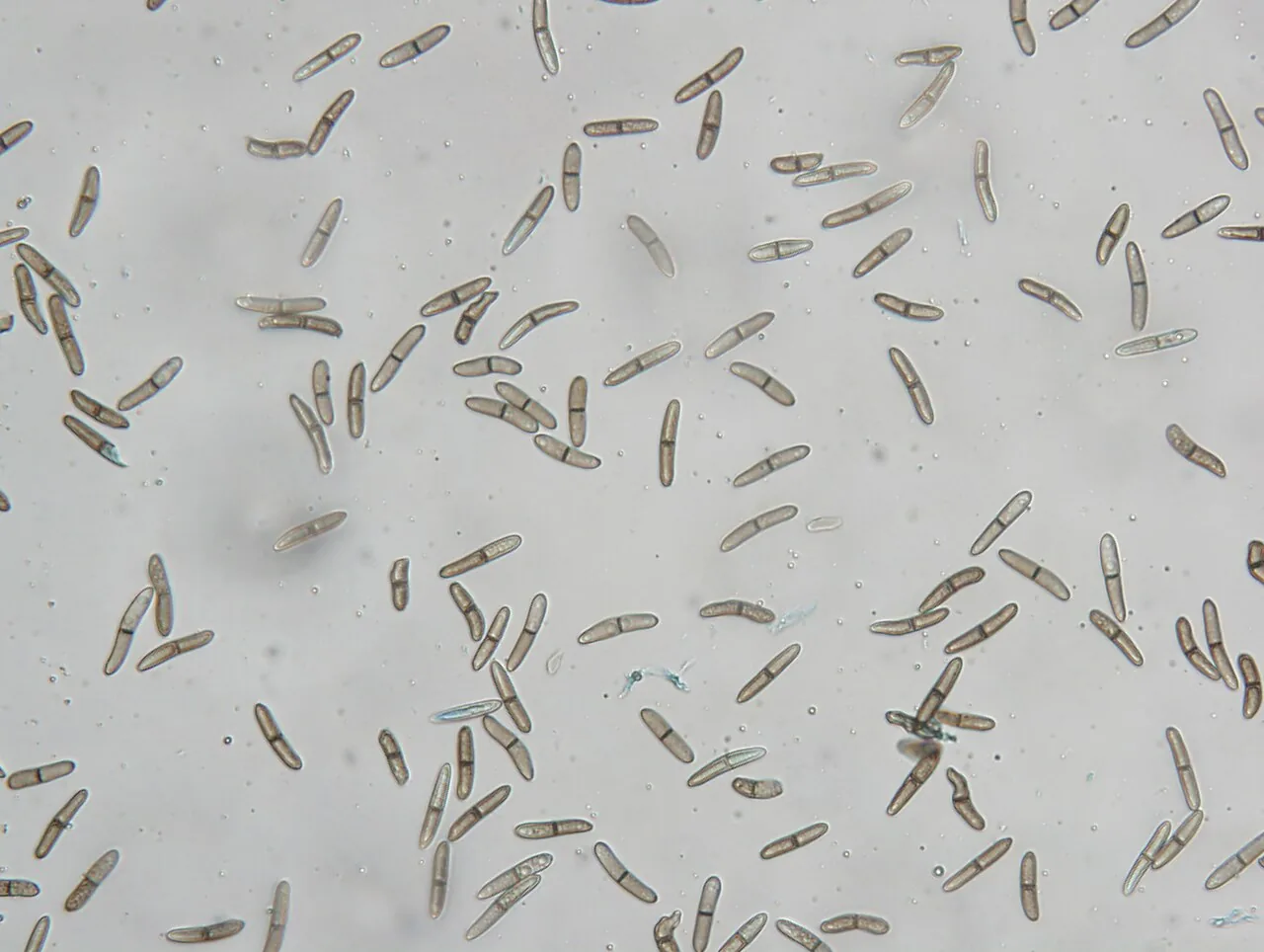 Stenocarpella maydis (Stenocarpella maydis) — photo mycologique