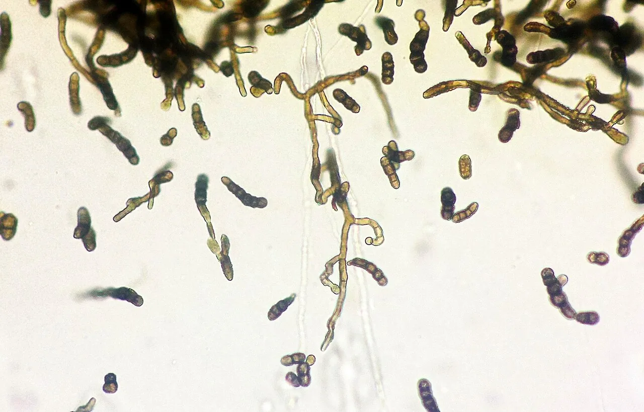 Taeniolella christiansenii (Taeniolella christiansenii) — photo mycologique