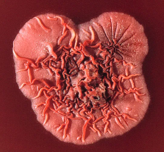 Talaromyces marneffei (Talaromyces marneffei) — photo mycologique