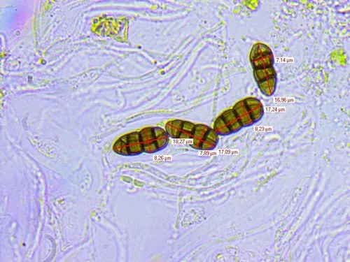 Teichospora tennesseensis (Teichospora tennesseensis) — photo mycologique