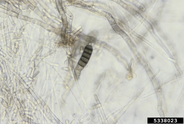 Thielaviopsis radicicola (Thielaviopsis radicicola) — photo mycologique