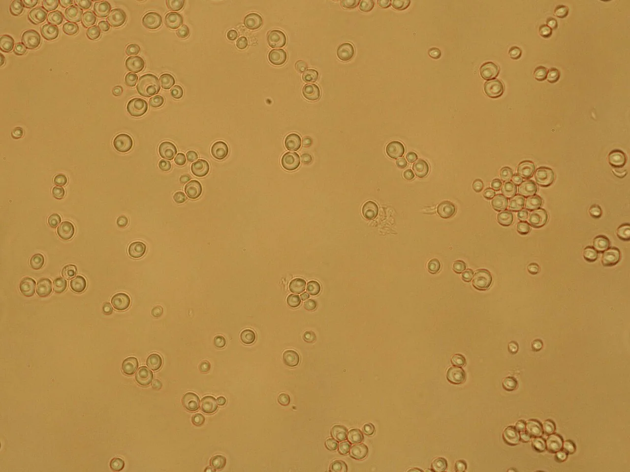 Torulaspora globosa (Torulaspora globosa) — photo mycologique