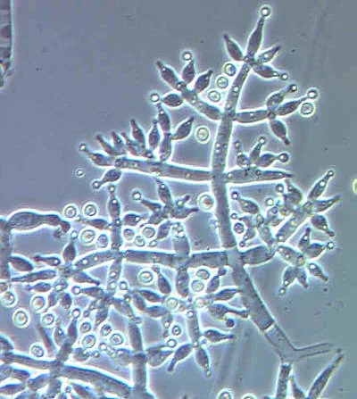 Trichoderma yui (Trichoderma yui) — photo mycologique