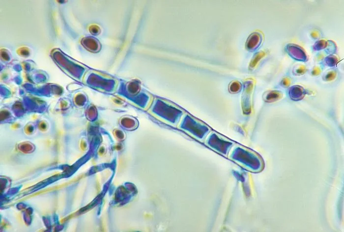 Trichophyton benhamiae (Trichophyton benhamiae) — photo mycologique