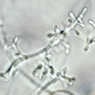 Trichophyton soudanense (Trichophyton soudanense) — photo mycologique