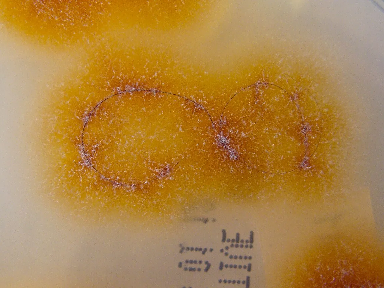 Trichophyton tonsurans (Trichophyton tonsurans) — photo mycologique