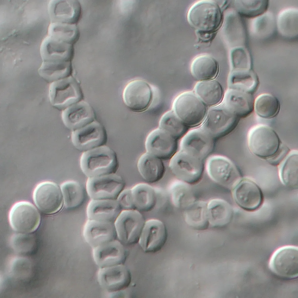 Trichophyton verrucosum (Trichophyton verrucosum) — photo mycologique