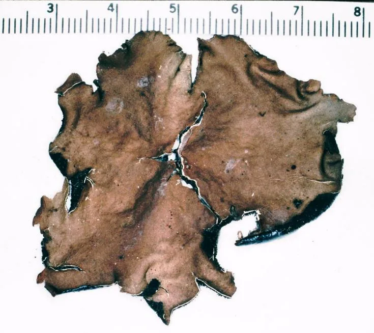 Umbilicaria mammulata (Umbilicaria mammulata) — photo mycologique