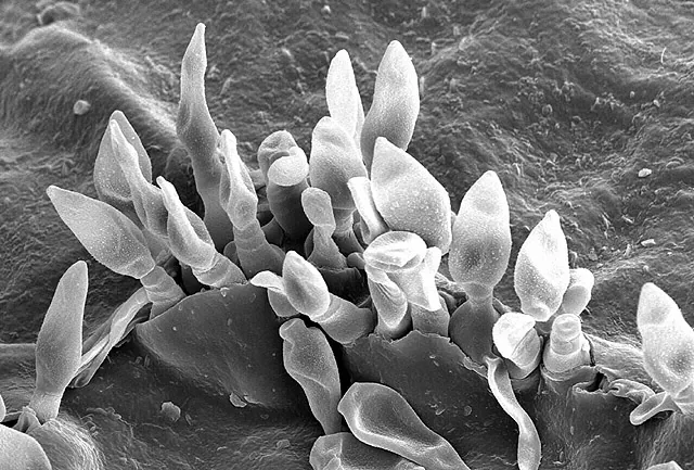 Venturia inaequalis (Venturia inaequalis) — photo mycologique
