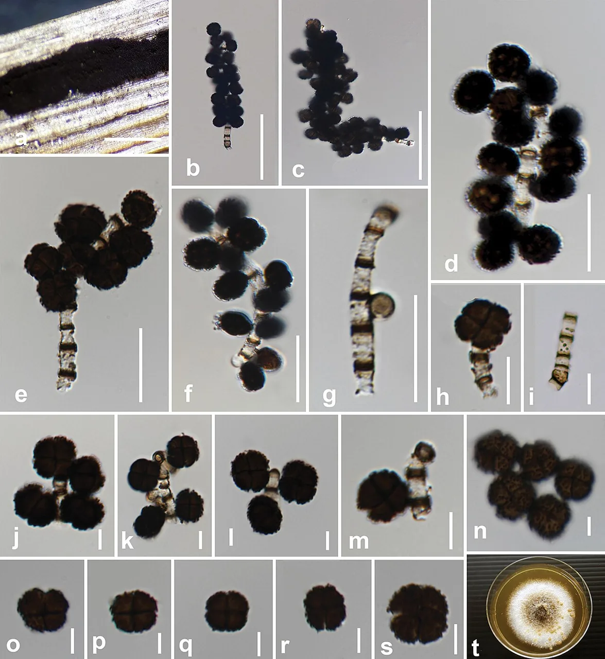 Verrucoconiothyrium ambiguum (Verrucoconiothyrium ambiguum) — photo mycologique